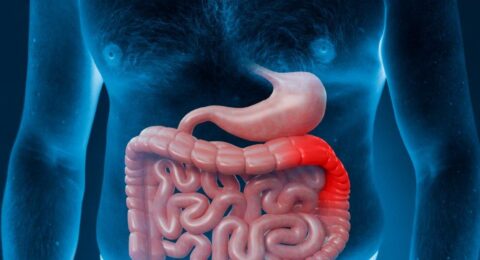 Imagem do post Especialistas alertam sobre importância  da colonoscopia para prevenção do câncer colorretal