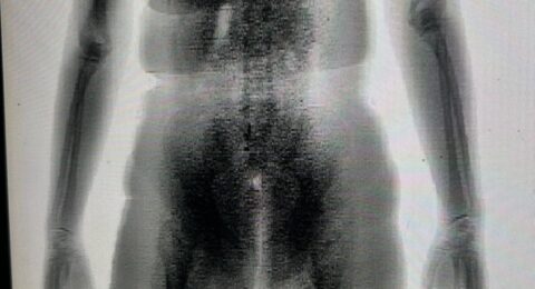 Imagem do post BodyScan flagra mulher com drogas no Conjunto Penal de Juazeiro