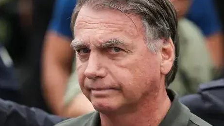 Imagem do post Bolsonaro passará por perícia médica determinada pelo STF