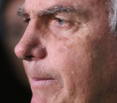 Imagem do post Bolsonaro passa por novo procedimento após crise de soluços