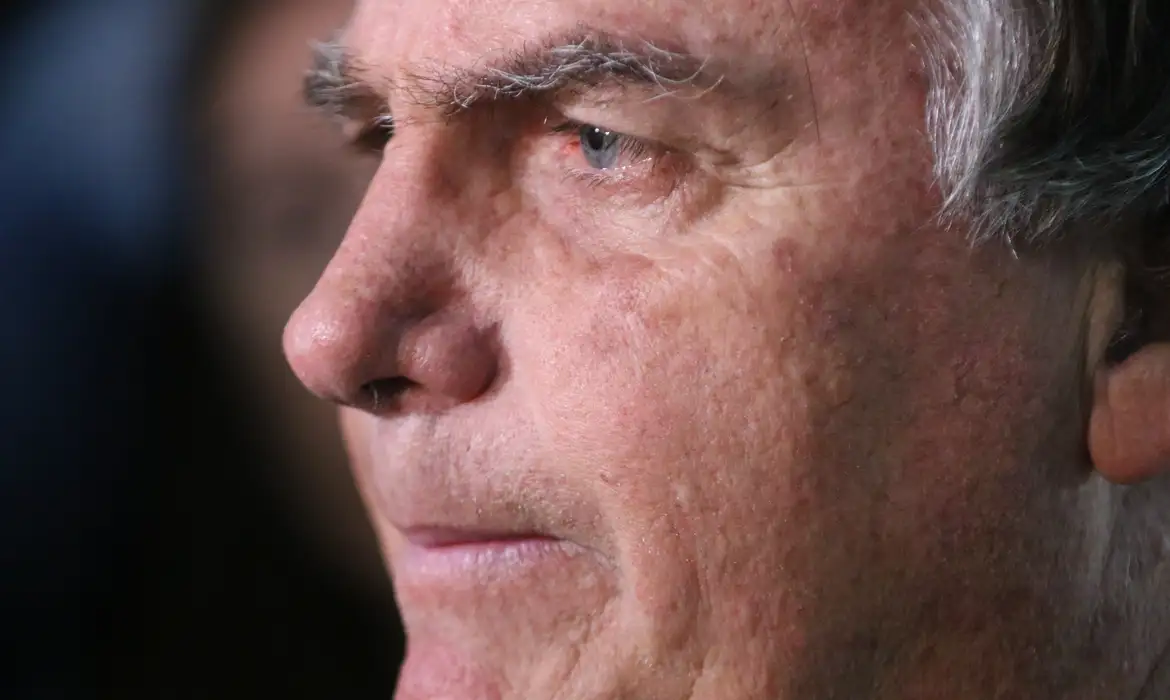 Imagem do post Bolsonaro passa por novo procedimento após crise de soluços