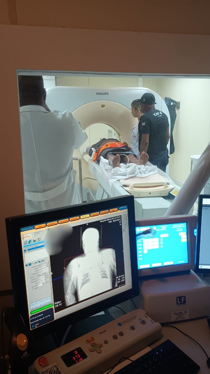 BodyScan flagra internos com drogas ingeridas em Lauro de Freitas